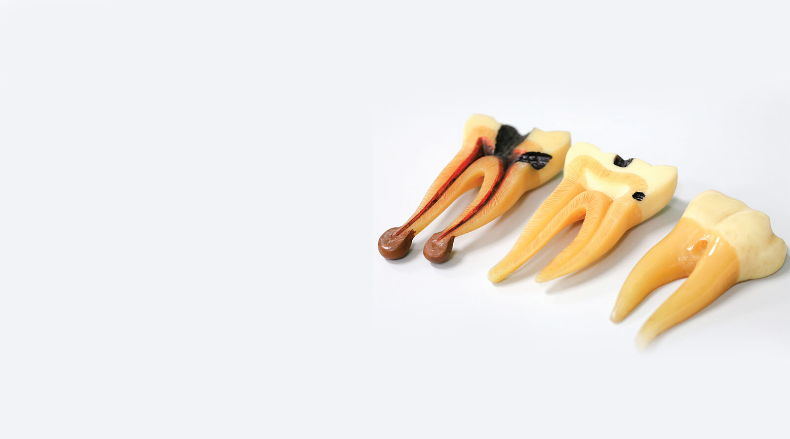 Dentes cortados mostrando canal dentário