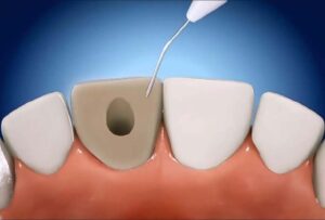 Dentista luis morato claremento interno divinópolis